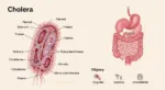 Cholera Bakteria Vibrio Cholerae